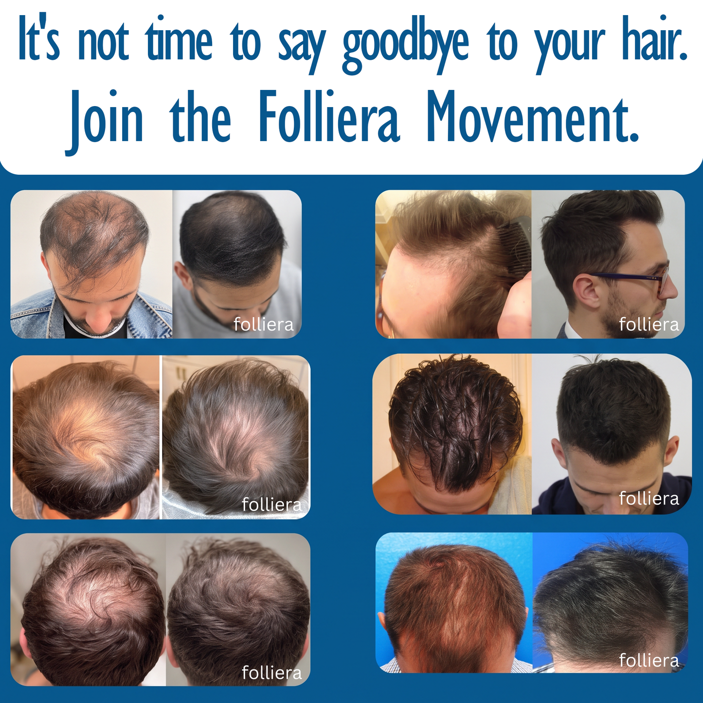 The Most Effective Peptide Infusion Hair Regrowth System