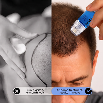 The Most Effective Peptide Infusion Hair Regrowth System