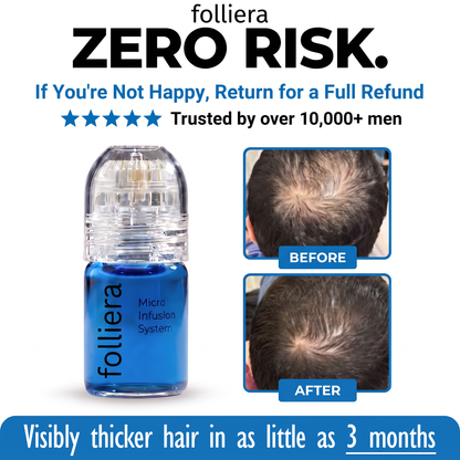 The Most Effective Peptide Infusion Hair Regrowth System
